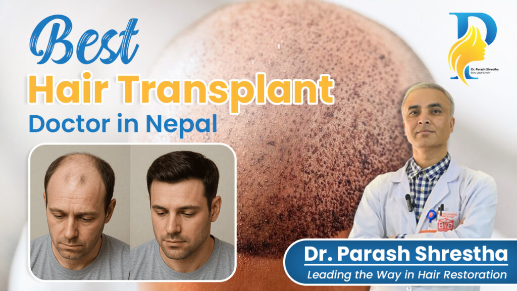 Best hair transplant doctor