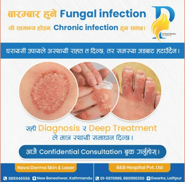 dermatologist in Kathmandu

