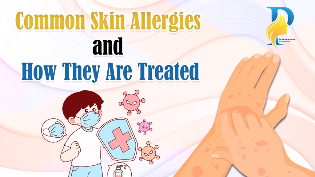 skin allergies
