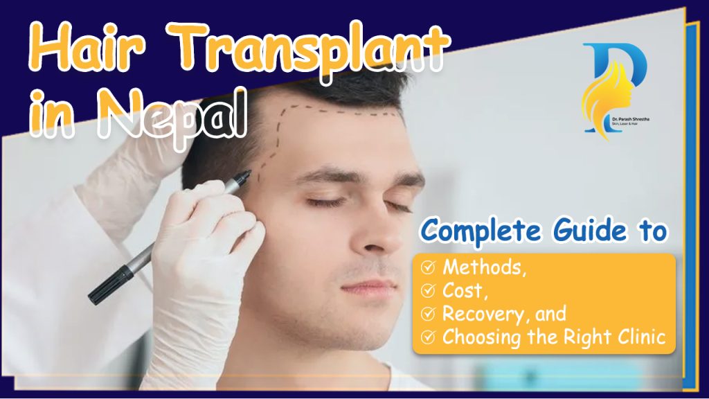 hair transplant in nepal
