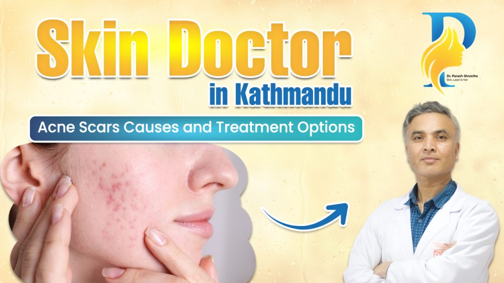 skin doctor in kathmandu