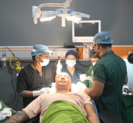 hair transplant nepal