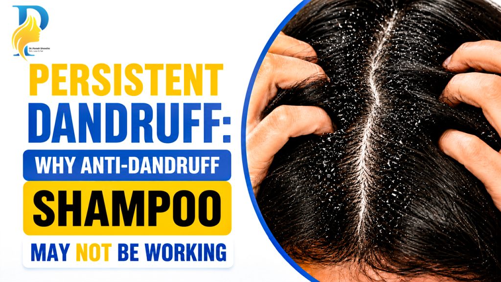 Persistent Dandruff