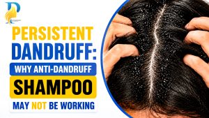 Persistent Dandruff